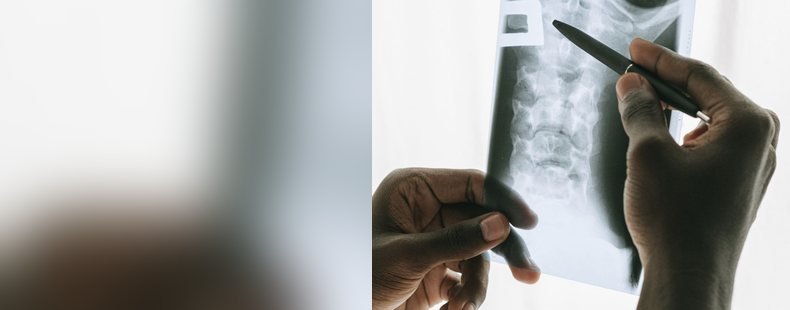 Consultant reviewing an X-ray at Narayan Hospital, Gorakhpur